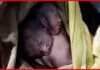 महिला ने दो सिर वाले बच्चे को दिया जन्म, देखने के लिए अस्पताल में लगी भीड़ two-headed-child