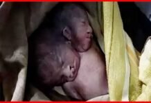 महिला ने दो सिर वाले बच्चे को दिया जन्म, देखने के लिए अस्पताल में लगी भीड़ two-headed-child