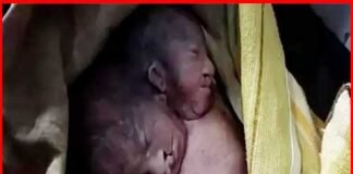 महिला ने दो सिर वाले बच्चे को दिया जन्म, देखने के लिए अस्पताल में लगी भीड़ two-headed-child
