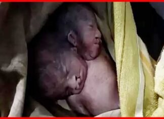 महिला ने दो सिर वाले बच्चे को दिया जन्म, देखने के लिए अस्पताल में लगी भीड़ two-headed-child
