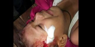 6 साल के मासूम पर आवारा कुत्ते ने किया जानलेवा हमला, गंभीर हालत में एम्स में भर्ती, सिर पर लगे हैं 20 टांके stray-dog-bite-child
