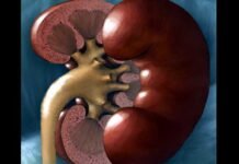 दिल्ली के डॉक्टरों ने दुर्लभ सर्जरी द्वारा मरीज के शरीर से निकाली 7.4 किलो की किडनी biggest-kidney