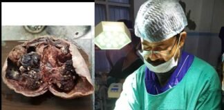 3 माह से परेशान पौड़ी की युवती के साढ़े 3 किलों के दुर्लभ ट्यूमर का डॉ. टम्टा ने किया सफल ऑपरेशन tumor-of-3-and-a-half-forts
