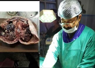3 माह से परेशान पौड़ी की युवती के साढ़े 3 किलों के दुर्लभ ट्यूमर का डॉ. टम्टा ने किया सफल ऑपरेशन tumor-of-3-and-a-half-forts