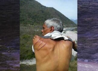 सतपुली : मंदिर जा रहे व्यक्ति पर भालू ने हमला कर किया घायल bear-attacked-man-in-satpuil