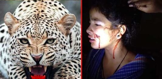 Leopard-attacked-girl in pauri garhwal