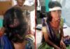 घास लेने गई महिला को भालू ने हमला कर किया घायल Woman attacked by bear