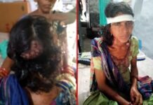 घास लेने गई महिला को भालू ने हमला कर किया घायल Woman attacked by bear
