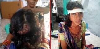 घास लेने गई महिला को भालू ने हमला कर किया घायल Woman attacked by bear