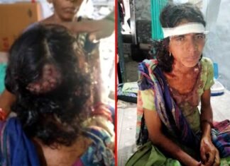 घास लेने गई महिला को भालू ने हमला कर किया घायल Woman attacked by bear