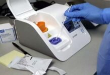 टीबी मरीजों की जांच के लिए लगी तीन ट्रूनेट मशीन, अब जिले में तुरंत जांच और तुरंत इलाज की व्यवस्था उपलब्ध : डॉ. जैन trunet machines for TB testing