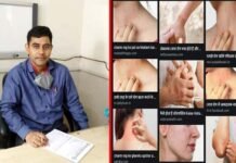 साफ-सफाई का अभाव और सघन रहन-सहन है त्वचा रोग का कारण : डा. अभिषेक दुबे Cause-of-skin-disease