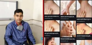 साफ-सफाई का अभाव और सघन रहन-सहन है त्वचा रोग का कारण : डा. अभिषेक दुबे Cause-of-skin-disease