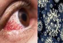 कोरोना महामारी के बीच देश में बढ़ने लगा है ब्लैक फंगस का खतरा, क्या है ब्लैक फंगस?, जानें लक्षण और बचने का तरीका black fungus