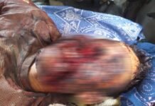 पौड़ी गढ़वाल : जंगल में गए युवक पर भालू ने किया हमला, गंभीर रूप से घायल युवक को लहूलुहान हालत में एम्स ऋषिकेश रेफर किया गया Bear-attacked-youth-in-Pauri garhwal