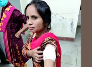 पौड़ी गढ़वाल : घास काटने खेतों में गई महिला को गुलदार ने किया घायल