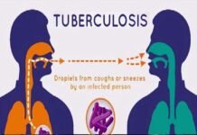 गौतमबुद्ध नगर जनपद में 185 टीम घर-घर खोजेंगी टीबी के मरीज, 9 मार्च से, 92815 घरों का होगा सर्वे TB-patients-in-Gautam-Budh-nagar