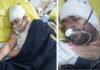 ग्रेटर नोएडा में तेज रफ्तार कार ने पांच छात्र-छात्राओं को कुचला, एक छात्र की मौत, तीन छात्राओं सहित चार घायल car-accident-greater-noida