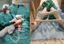 नोएडा के चाइल्ड पीजीआई में स्टेम सेल प्रत्यारोपित कर हुआ पर्थेस रोग का उपचार, पहली बार हुआ इस तकनीक से इलाज transplanting stem cells in Child PGI Noida