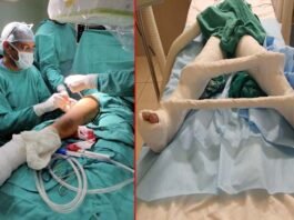 नोएडा के चाइल्ड पीजीआई में स्टेम सेल प्रत्यारोपित कर हुआ पर्थेस रोग का उपचार, पहली बार हुआ इस तकनीक से इलाज transplanting stem cells in Child PGI Noida
