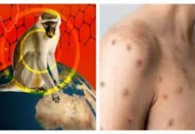 रहें सचेत : देश में महामारी की ‘डबल दहशत’, कोरोना के साथ मंकीपॉक्स की भी बढ़ी रफ्तार, गाइडलाइन जारी Monkeypox Virus: