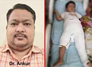डेवलपमेंटल डिस्प्लेजिआ ऑफ़ हिप की समस्या से जूझ रही ढाई साल की बच्ची के एक कूल्हे की सफल सर्जरी, 20-25 दिन बाद दूसरे कूल्हे की होगी सर्जरी