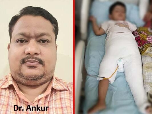 डेवलपमेंटल डिस्प्लेजिआ ऑफ़ हिप की समस्या से जूझ रही ढाई साल की बच्ची के एक कूल्हे की सफल सर्जरी, 20-25 दिन बाद दूसरे कूल्हे की होगी सर्जरी