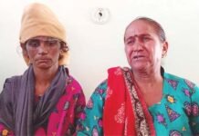 देहरादून : ससुरालियों ने अमानवीयता की सारे हदें की पार, विवाहिता को गर्म तवे और गर्म पानी डालकर जलाया, 15 दिन तक रखा भूखा प्यासा burn-marks-on-entire-body-of-married-woman