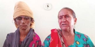 देहरादून : ससुरालियों ने अमानवीयता की सारे हदें की पार, विवाहिता को गर्म तवे और गर्म पानी डालकर जलाया, 15 दिन तक रखा भूखा प्यासा burn-marks-on-entire-body-of-married-woman