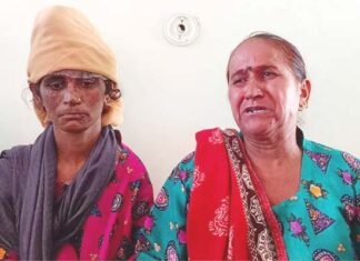 देहरादून : ससुरालियों ने अमानवीयता की सारे हदें की पार, विवाहिता को गर्म तवे और गर्म पानी डालकर जलाया, 15 दिन तक रखा भूखा प्यासा burn-marks-on-entire-body-of-married-woman