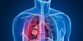 Lungs कैंसर की मिली रामबाण दवा!, कितनी है असरदार, रिसर्च में वैज्ञानिकों ने किया बड़ा दावा lungs cancer