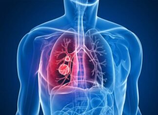 Lungs कैंसर की मिली रामबाण दवा!, कितनी है असरदार, रिसर्च में वैज्ञानिकों ने किया बड़ा दावा lungs cancer