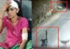 खेत में घास काट रही महिला पर झपटा गुलदार, कमला देवी की हिम्मत की देनी होगी दाद, लड़कर बचाई अपनी जान