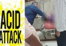 लखनऊ में सरेराह छात्रा पर एसिड अटैक, तेजाब से झुलसा चेहरा, बचाने में भाई भी आया चपेट में acid attack